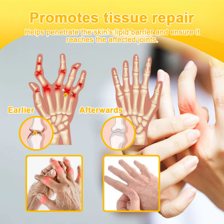 ADNOON® Botulinum Toxin & Bee Venom Pain-Relief Bone Healing Cream(Specially for older adults)