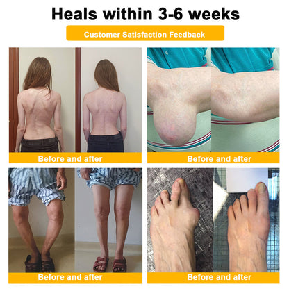ADNOON® Botulinum Toxin & Bee Venom Pain-Relief Bone Healing Cream(Specially for older adults)