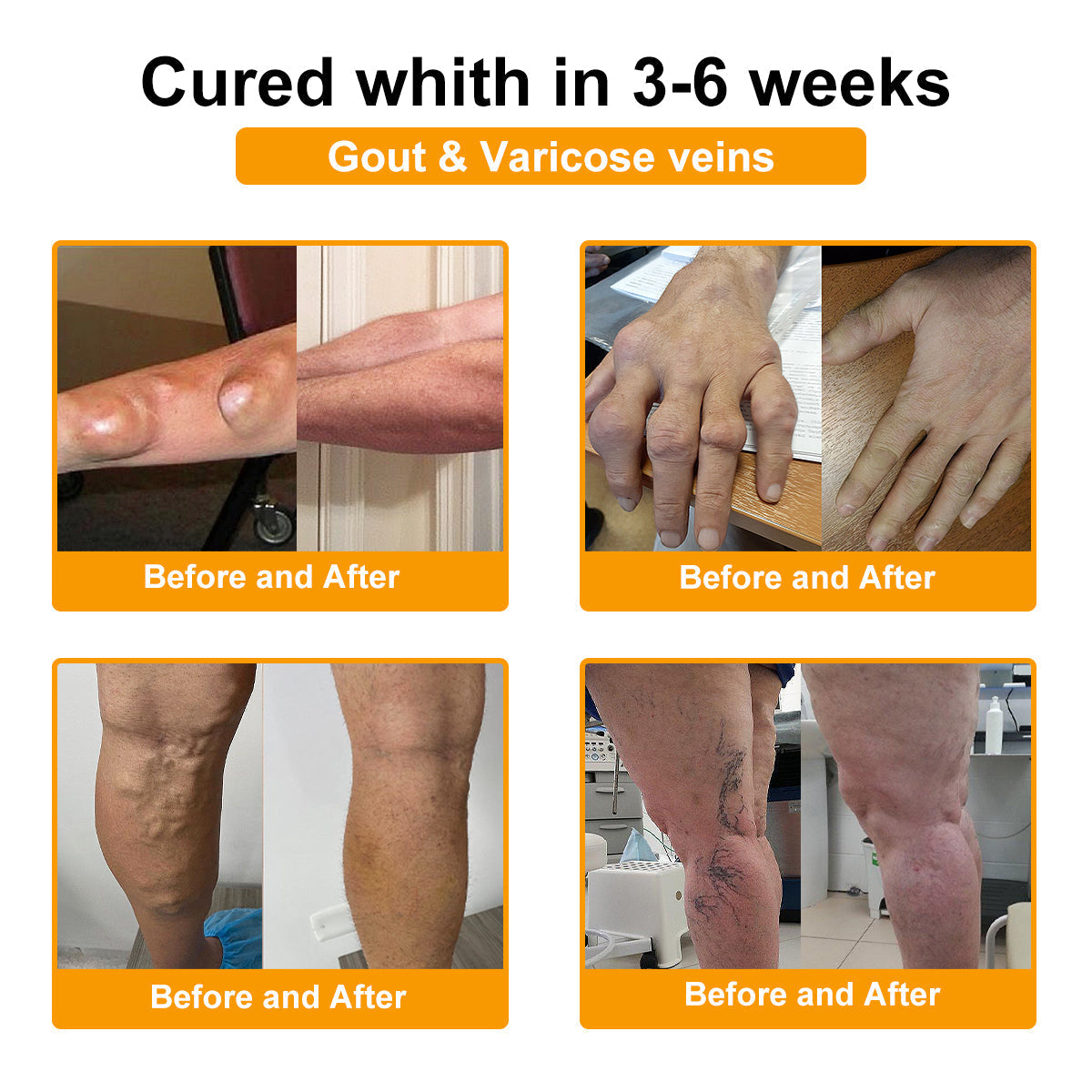 ADNOON® Botulinum Toxin & Bee Venom Pain-Relief Bone Healing Cream(Specially for older adults)