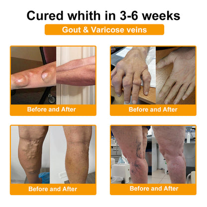 ADNOON® Botulinum Toxin & Bee Venom Pain-Relief Bone Healing Cream(Specially for older adults)