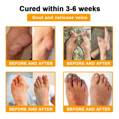 ADNOON® Botulinum Toxin & Bee Venom Pain-Relief Bone Healing Cream(Specially for older adults)