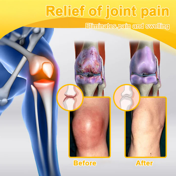 ADNOON® Botulinum Toxin & Bee Venom Pain-Relief Bone Healing Cream(Specially for older adults)